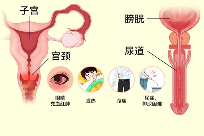 患者查收！太原能看好性病的医院-淋病尿血的治疗方法