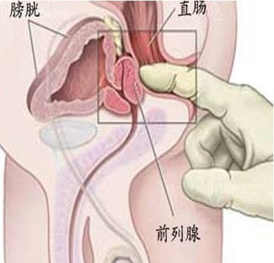 大埔那打素医院高流量手术 缩短前列腺病人轮候时间