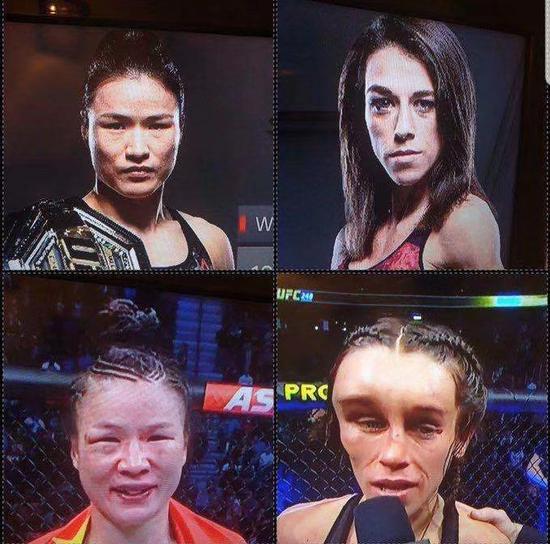 第17位中国选手与UFC签约 医生转型格斗冠军