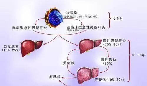 60岁女病人对丙型肝炎呈阳性 曾入住有病人感染的同一病房